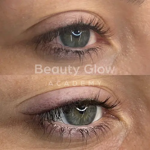 Micropigmetacao Delineador De Olhos Antes E Depois